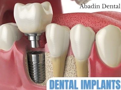 Abadin Dental Coral Gables 