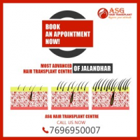 ASG Hair Transplant Centre in Jalandhar, Jalandhar ASG Hair Transplant Centre in Jalandhar, Jalandhar