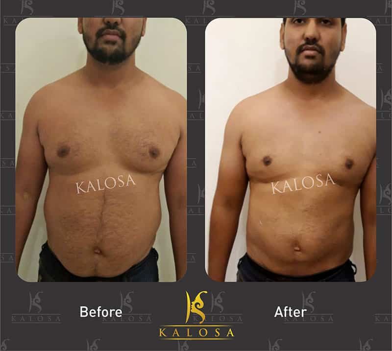 Kalosa Aesthetics & Cosmetic Gynaecology Clinic Delhi