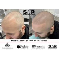 smp hair tattoo canada, Toronto smp hair tattoo canada, Toronto