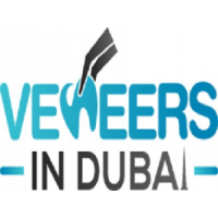 Veneers in Dubai, Dubai