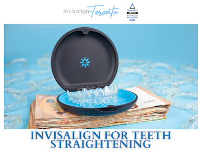 Invisalign Toronto Toronto
