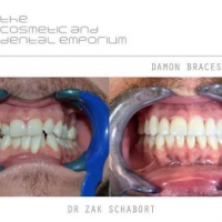 Cape Town Dentist, Cape Town Cape Town Dentist, Cape Town