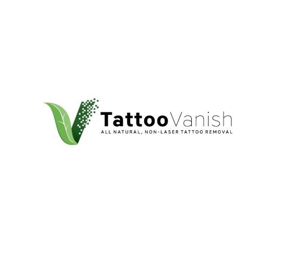 Tattoo Vanish, Hialeah