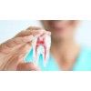 Best root canal treatments in Kothrud
