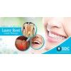Dental Laser Treatment, Laser Root Canal Treatment Cost In Chennai