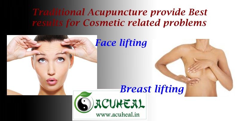 Chennai Traditional Acupuncture and Acupressure for Cosmetic Treatment
