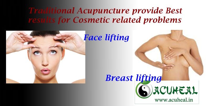 Cosmetic Acupuncture & Acupressure treatment without drugs and Side effects 