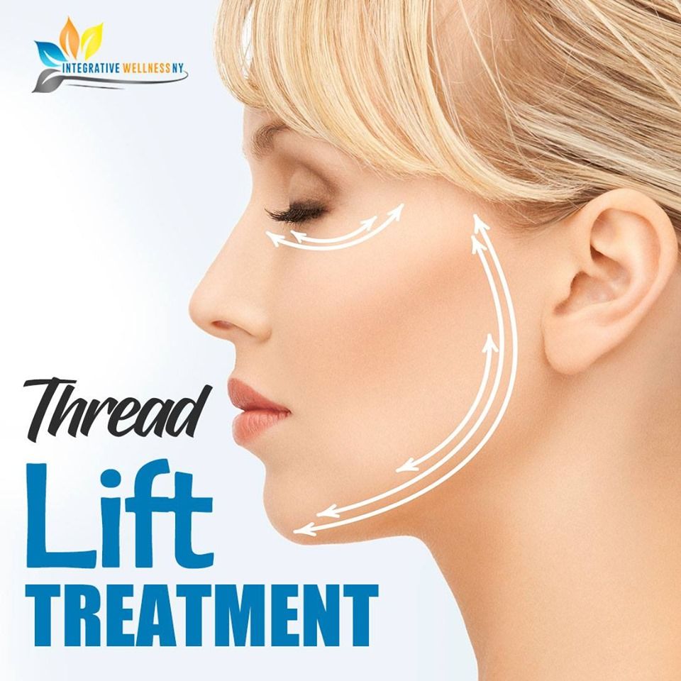 Threat Lift $3000 (per procedure) 