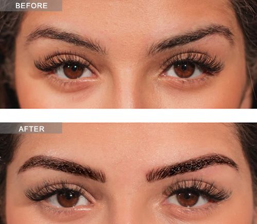 Microblading Eyebrows NYC | Best Aesthetic Specialist in Midtown 