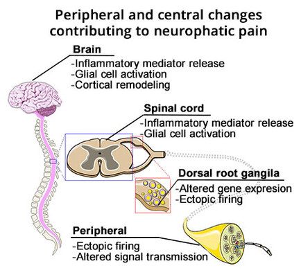 Neurological Disorders | Best Neurologist in Brooklyn