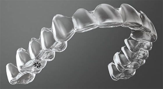 Invisalign Invisible Braces