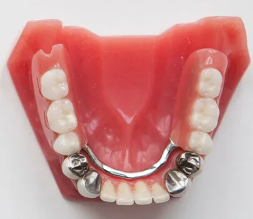 Denture processing, denture processing plant, zirconia porcelain teeth, invisible teeth, pure titanium baking
