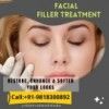 A filler treatment is a cosmetic dermatological procedure