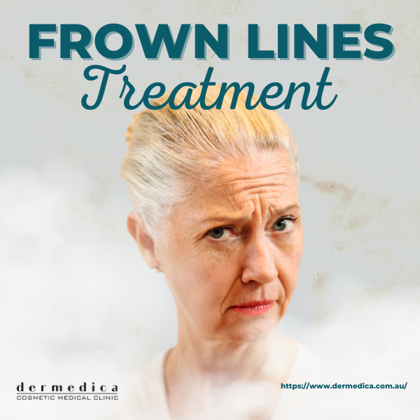 Frown Lines Treatment available at Dermedica 