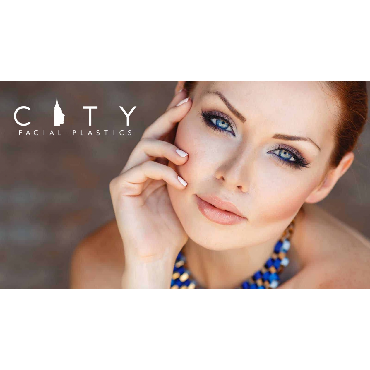 Lip lift