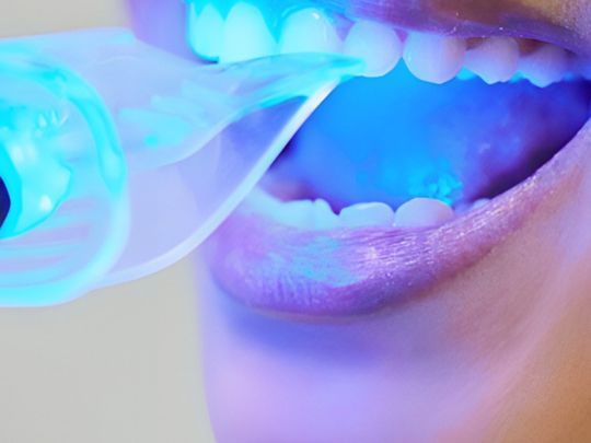 Teeth Whitening