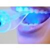 Teeth Whitening