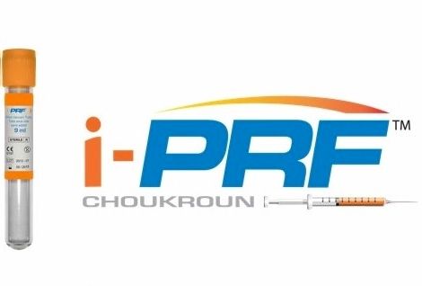 i-PRF terápia
