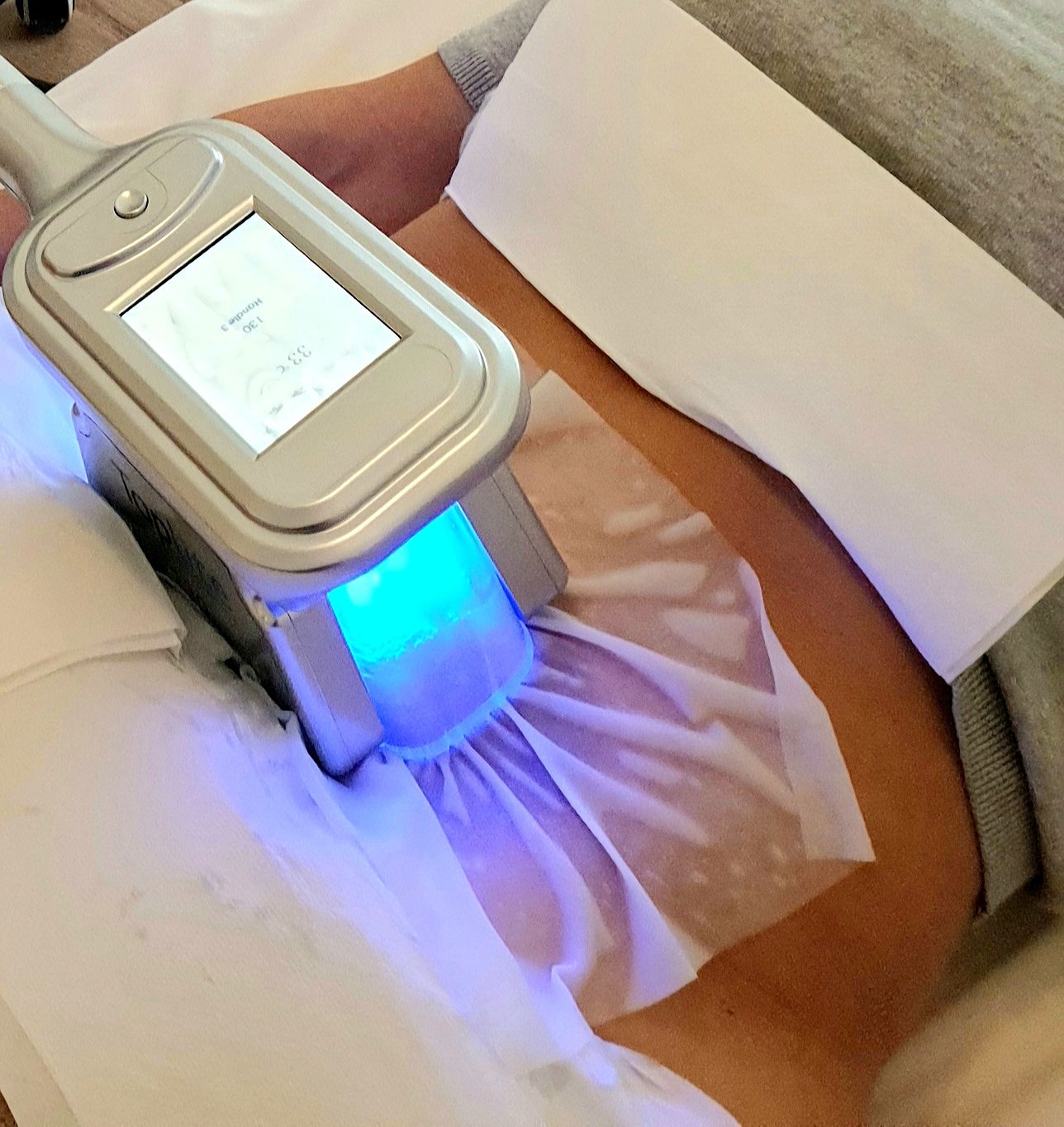 Kryolipolyse statt Fettabsaugung - Fettabsaugen oder Fett-weg-Spritze Potsdam - Berlin - Zehlendorf - Wannsee