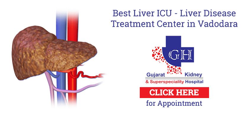 Liver cirrhosis treatment - Gujarat Kidney Hospital